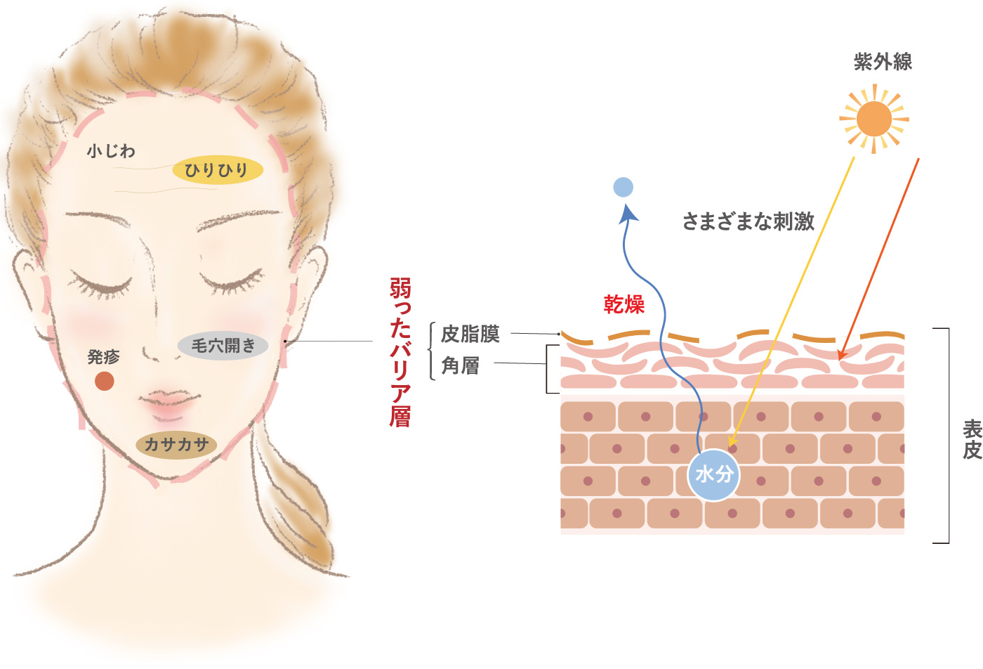 弱ったバリア層